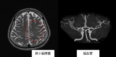 Mri検査 広島市南区の内科 外科 広島みなとクリニック 日曜診療 Mri検査 睡眠障害