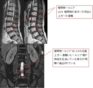 費用 mri 検査